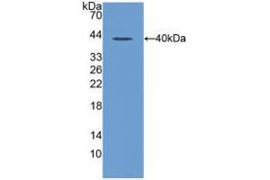 Western blot analysis of recombinant Rat MIP1a. (CCL3 Antikörper  (AA 24-92))
