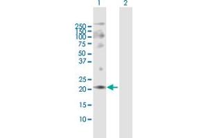 Western Blot analysis of ANAPC10 expression in transfected 293T cell line by ANAPC10 MaxPab polyclonal antibody. (ANAPC10 Antikörper  (AA 1-185))