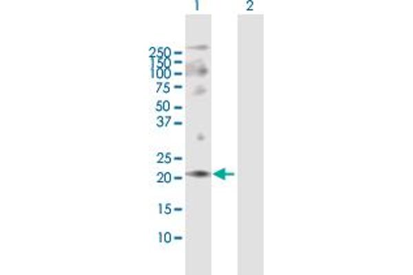 ANAPC10 Antikörper  (AA 1-185)