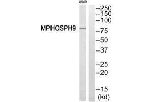 Western blot analysis of extracts from A549 cells, using MPHOSPH9 antibody. (KIF2B Antikörper  (C-Term))