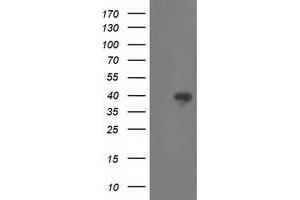 Western Blotting (WB) image for anti-Retinaldehyde Binding Protein 1 (RLBP1) antibody (ABIN1497623) (RLBP1 Antikörper)