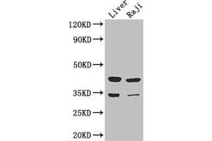 Western Blot Positive WB detected in: Mouse liver tissue, Raji whole cell lysate All lanes: BHMT2 antibody at 3 μg/mL Secondary Goat polyclonal to rabbit IgG at 1/50000 dilution Predicted band size: 41, 34 kDa Observed band size: 41, 34 kDa