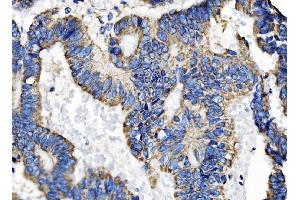 IHC analysis of TOMM70 using anti-TOMM70 antibody (ABIN7599855).