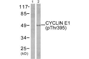 Western Blotting (WB) image for anti-Cyclin E1 (CCNE1) (pThr395) antibody (ABIN1847246) (Cyclin E1 Antikörper  (pThr395))
