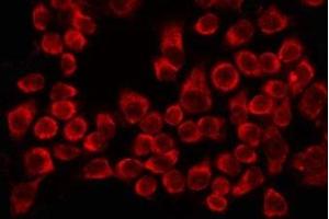 ABIN6275625 staining HeLa by IF/ICC. (CCT8 Antikörper  (Internal Region))