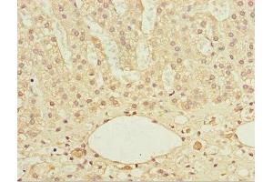 Immunohistochemistry of paraffin-embedded human adrenal gland tissue using ABIN7172122 at dilution of 1:100 (DTYMK Antikörper  (AA 1-212))