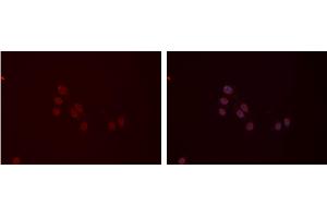 ABIN6277410 staining Hela cells by IF/ICC. (MYL9 Antikörper  (N-Term))