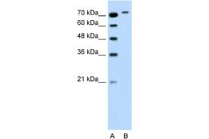 WB Suggested Anti-RHOBTB1 Antibody Titration:  0.