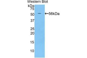 Detection of Recombinant BACE2, Rat using Polyclonal Antibody to Beta Secretase 2 (BACE2) (BACE2 Antikörper  (AA 242-502))