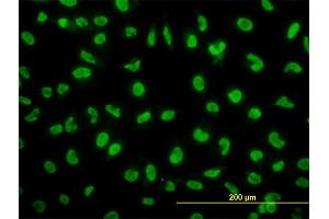 Immunofluorescence of monoclonal antibody to SNAI2 on HeLa cell. (SLUG Antikörper  (AA 97-169))
