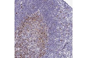 Immunohistochemical staining of human lymph node with IFITM1 polyclonal antibody  shows strong cytoplasmic positivity in lymphoid cells outside reaction centra at 1:200-1:500 dilution. (TIPIN Antikörper)