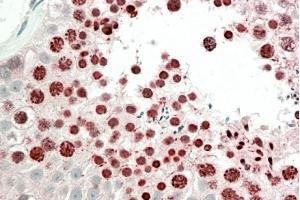ABIN5868646 (5 µg/ml) staining of paraffin embedded Human Testis. (HOXA10 Antikörper)