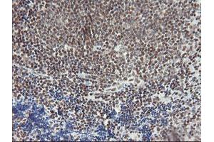 Image no. 5 for anti-Malignant T Cell Amplified Sequence 1 (MCTS1) (AA 1-181) antibody (ABIN1490599)