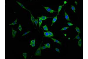 Immunofluorescence staining of NIH/3T3 cells with ABIN7143720 at 1:166, counter-stained with DAPI. (AGPS Antikörper  (AA 279-400))