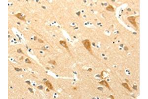 The image on the left is immunohistochemistry of paraffin-embedded Human brain tissue using ABIN7131272(SYT5 Antibody) at dilution 1/15, on the right is treated with fusion protein. (Synaptotagmin V Antikörper)