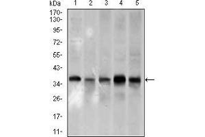 Western blot analysis using PCNA mouse mAb against A431 (1), HeLa (2), HepG2 (3), Raji (4), and MOLT4 (5) cell lysate. (PCNA Antikörper  (AA 53-196))