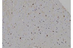 ABIN6266337 and ABIN6277059 at 1/100 staining Human heart tissue by IHC-P. (E2F1 Antikörper  (C-Term))