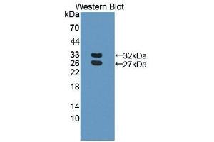 Detection of Recombinant BCAM, Human using Polyclonal Antibody to Basal Cell Adhesion Molecule (BCAM) (BCAM Antikörper  (AA 32-257))
