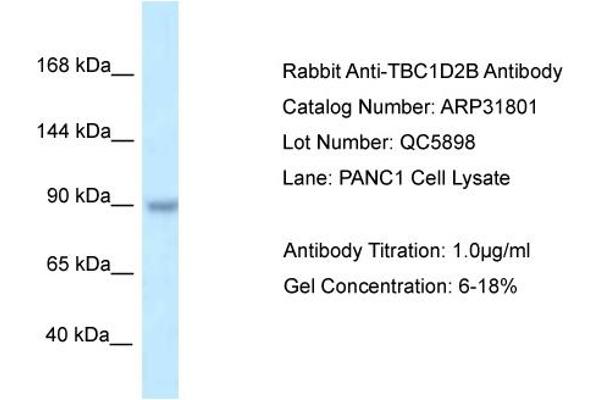 TBC1D2B Antikörper  (C-Term)