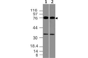 Image no. 1 for anti-Melanoma Associated Antigen (Mutated) 1 (MUM1) (AA 52-278) antibody (ABIN5027377) (MUM1 Antikörper  (AA 52-278))