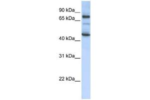GAS2L1 antibody used at 1 ug/ml to detect target protein. (GAS2L1 Antikörper  (Middle Region))