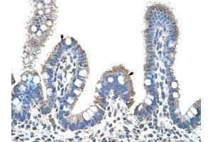 SLC22A1 antibody was used for immunohistochemistry at a concentration of 4-8 ug/ml to stain Epithelial cells of intestinal villus (arrows) in Human Intestine. (SLC22A1 Antikörper)