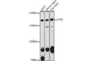Western blot analysis of extracts of various cell lines, using CFTR antibody (ABIN6129855, ABIN6138469, ABIN6138470 and ABIN6224429) at 1:1000 dilution. (CFTR Antikörper  (AA 1161-1480))