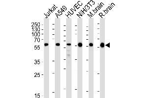 Western blot analysis of lysates from Jurkat, A549, HUVEC, mouse NIH/3T3 cell line and mouse brain, rat brain tissue lysates (from left to right), using RAD23B Antibody (N-term) (ABIN1944896 and ABIN2843646).