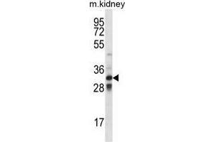 TLX1 Antibody (Center) western blot analysis in mouse kidney tissue lysates (35 µg/lane).