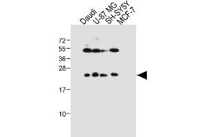 All lanes : Anti-PRL Antibody (Center) at 1:1000 dilution Lane 1: Daudi whole cell lysate Lane 2: U-87 MG whole cell lysate Lane 3: SH-SY5Y whole cell lysate Lane 4: MCF-7 whole cell lysate Lysates/proteins at 20 μg per lane. (Prolactin Antikörper  (AA 48-76))