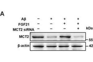 The roles of MCTs in the beneficial effects of FGF21.