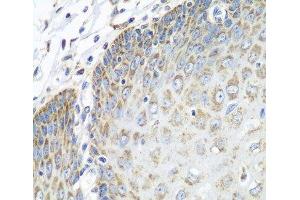 Immunohistochemistry of paraffin-embedded Human esophagus using TMOD3 Polyclonal Antibody at dilution of 1:100 (40x lens). (TMOD3 Antikörper)