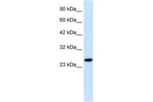 Western Blotting (WB) image for anti-Regulator of G-Protein Signaling 13 (RGS13) antibody (ABIN2460853) (RGS13 Antikörper)
