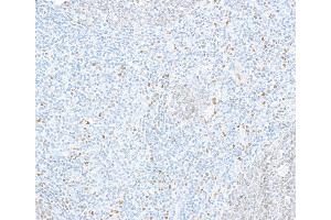 Immunohistochemistry (IHC) image for anti-Spleen Focus Forming Virus (SFFV) Proviral Integration Oncogene Spi1 (SPI1) (AA 1-50) antibody (ABIN7453984)