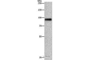 Western blot analysis of Human fetal brain tissue, using APLP1 Polyclonal Antibody at dilution of 1:650 (APLP1 Antikörper)