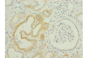 Immunohistochemistry of paraffin-embedded human kidney tissue using ABIN7173253 at dilution of 1:100 (TMEM61 Antikörper  (AA 90-210))
