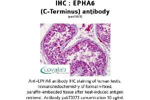 Image no. 2 for anti-EPH Receptor A6 (Epha6) antibody (ABIN1734079)