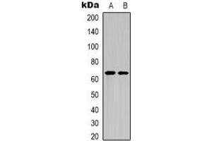 Western blot analysis of NF-kappaB p65 (AcK122) expression in HepG2 UV-treated (A), mouse brain (B) whole cell lysates. (NF-kB p65 Antikörper  (acLys122))