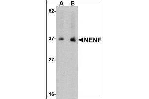 Western blot analysis of NENF in human kidney tissue lysate with this product at (A) 1 and (B) 2 μg/ml.