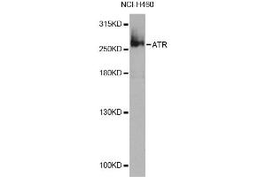 Western blot analysis of extracts of NCI-H460 cells, using ATR Antibody (ABIN4902988) at 1:1000 dilution. (ATR Antikörper)
