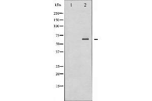 Western blot analysis of SHP-2 expression in A431 whole cell lysates,The lane on the left is treated with the antigen-specific peptide. (PTPN11 Antikörper  (C-Term))
