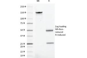 SDS-PAGE Analysis Purified CD43 Mouse Recombinant Monoclonal Antibody (rSPN/1094). (Rekombinanter CD43 Antikörper)