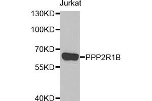 Western blot analysis of extracts of Jurkat cell line, using PPP2R1B antibody. (PPP2R1B Antikörper)