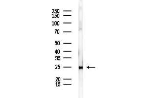 anti-Ribosomal Protein L14 (RPL14) (Internal Region) antibody
