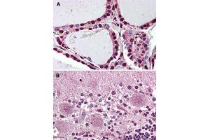 Immunohistochemical staining of human thyroid (A) and human brain, cerebellum (B) with PROKR2 polyclonal antibody . (Prokineticin Receptor 2 Antikörper  (N-Term))