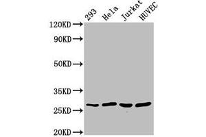 Western Blot Positive WB detected in: 293 whole cell lysate, Hela whole cell lysate, Jurkat whole cell lysate, HUVEC whole cell lysate All lanes: CACYBP antibody at 2. (CACYBP Antikörper  (AA 2-228))