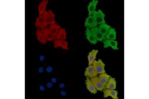 ABIN7095707 and ABIN7099769 staining HepG2 cells by IF/ICC.