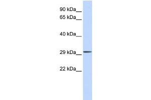 WB Suggested Anti-C1orf111 Antibody Titration:  0. (C1ORF111 Antikörper  (Middle Region))