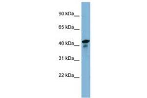 Image no. 1 for anti-UEV and Lactate/malate Dehyrogenase Domains (UEVLD) (AA 35-84) antibody (ABIN6742157) (UEVLD Antikörper  (AA 35-84))