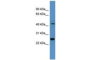 Image no. 1 for anti-Transcription Factor Dp-1 (TFDP1) (AA 21-70) antibody (ABIN6746158) (DP1 Antikörper  (AA 21-70))